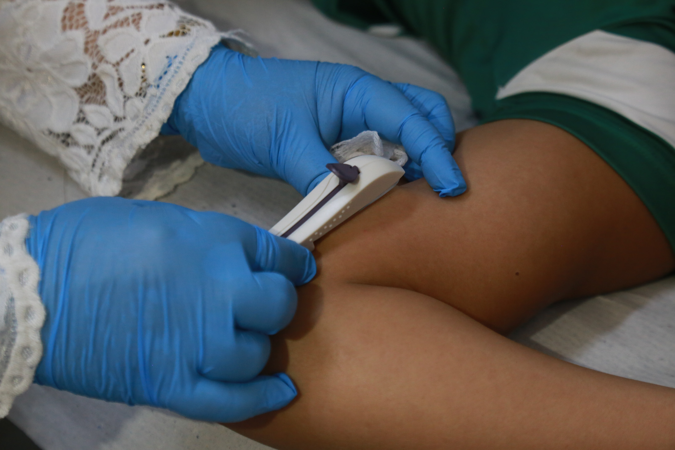 enfermeira aplica o implante no braço de uma mulher